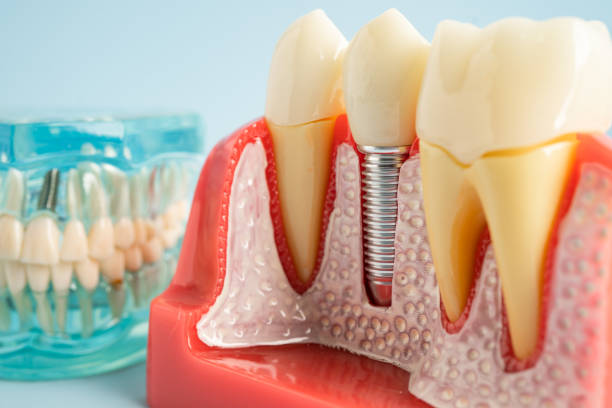 Reliable Kingston, NJ Dental Services Solutions